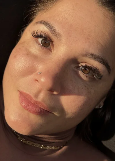 Beauty treatment results — Meraki Studio Miami
