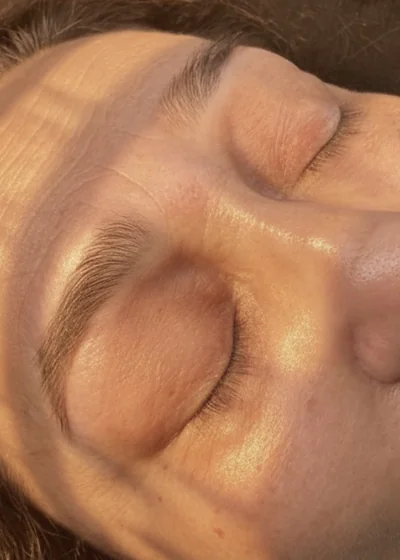 Beauty treatment results — Meraki Studio Miami