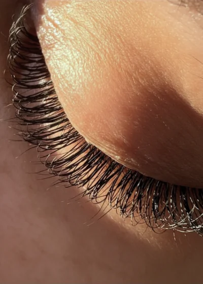 Beauty treatment results — Meraki Studio Miami