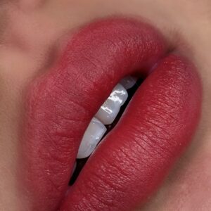 LIP PIGMENTATION